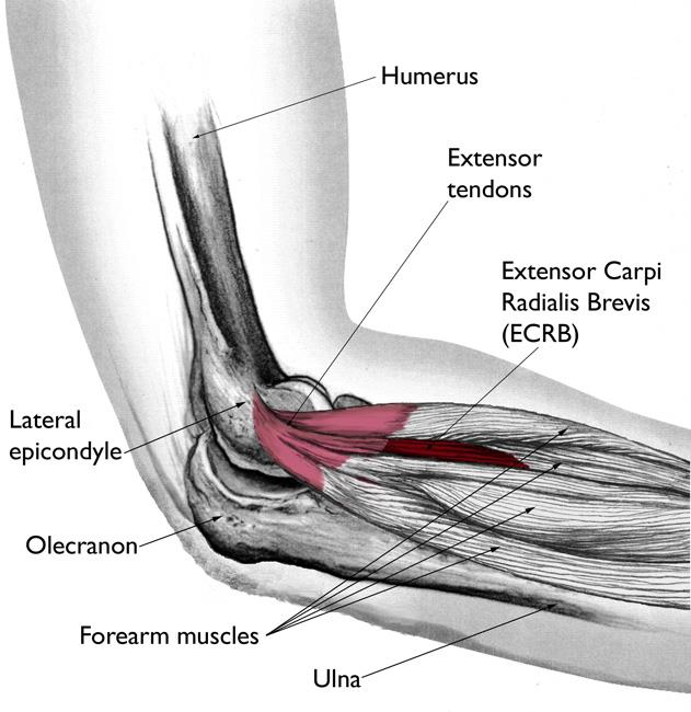 Elbow And Wrist Pain - Peak To Shore Physiotherapy & Sports Medicine