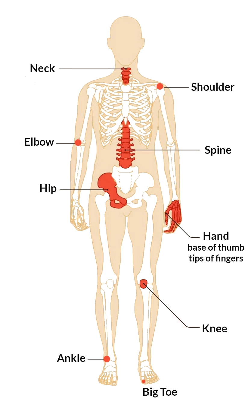 Osteoarthritis Specialist in Orange County